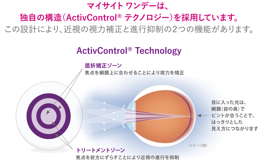 ActivControl Technology